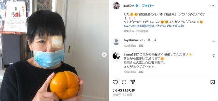 「右目が見えづらい」インスタ投稿